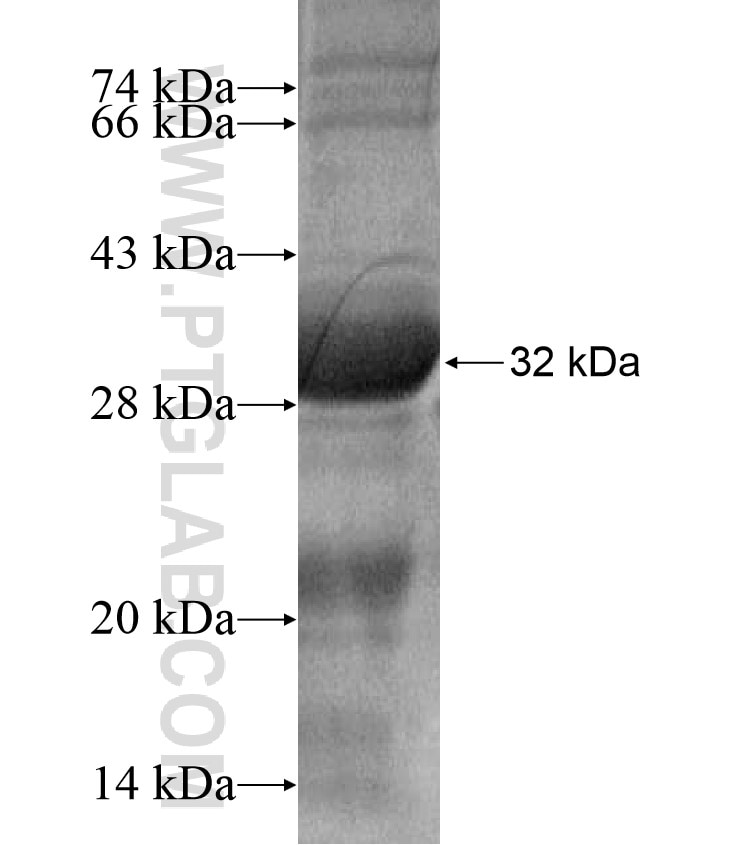 SEMA3E fusion protein Ag17126 SDS-PAGE