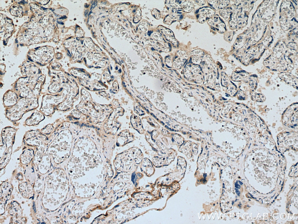 Immunohistochemistry (IHC) staining of human placenta tissue using SEMA4A Polyclonal antibody (27359-1-AP)