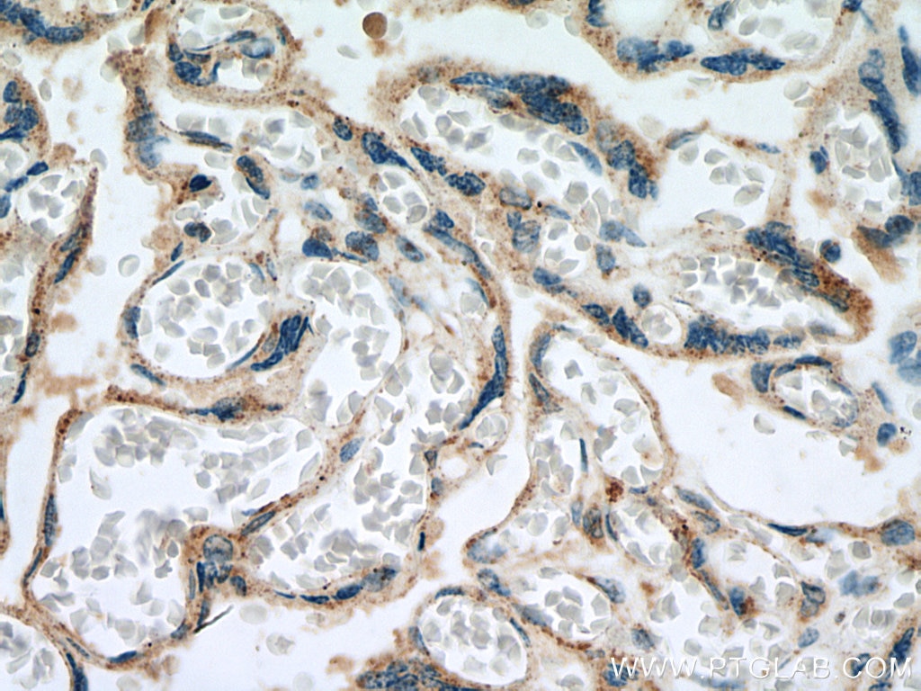 Immunohistochemistry (IHC) staining of human placenta tissue using SEMA4A Polyclonal antibody (27359-1-AP)