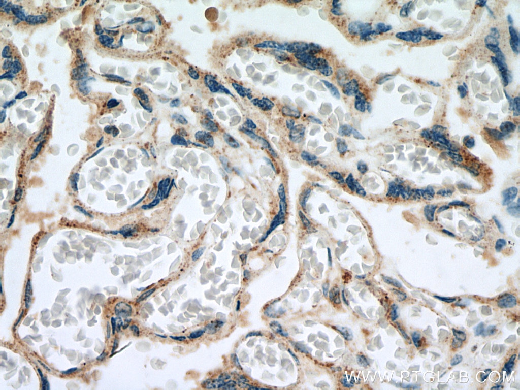 IHC staining of human placenta using 27359-1-AP