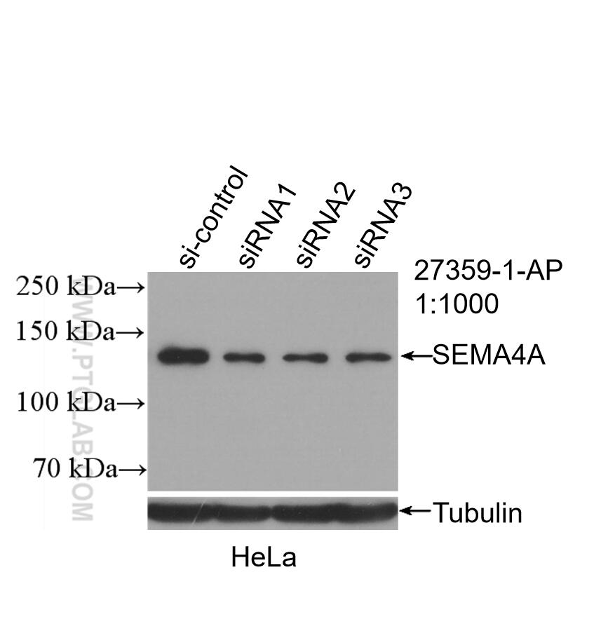 Western Blot (WB) analysis of HeLa cells using SEMA4A Polyclonal antibody (27359-1-AP)