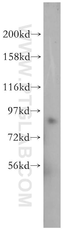Western Blot (WB) analysis of mouse pancreas tissue using SEMA4B Polyclonal antibody (16934-1-AP)