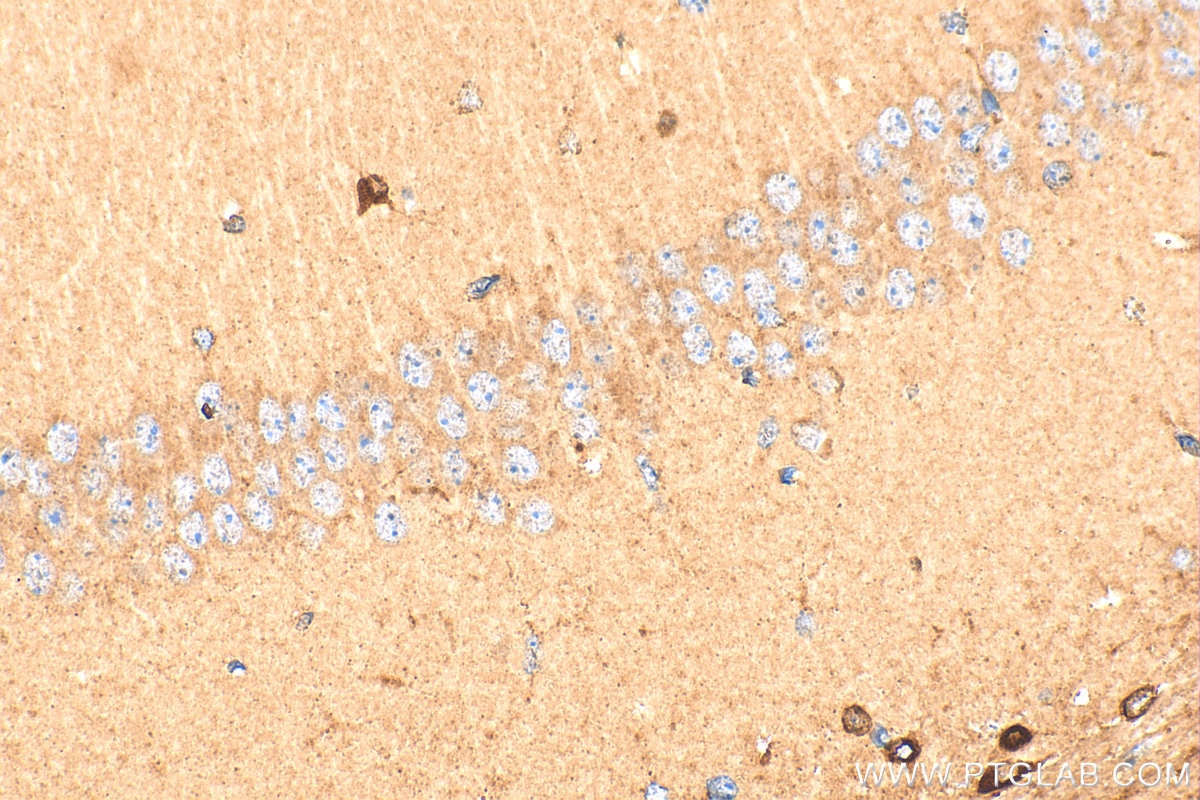 Immunohistochemistry (IHC) staining of mouse brain tissue using SEMA4B Polyclonal antibody (29191-1-AP)