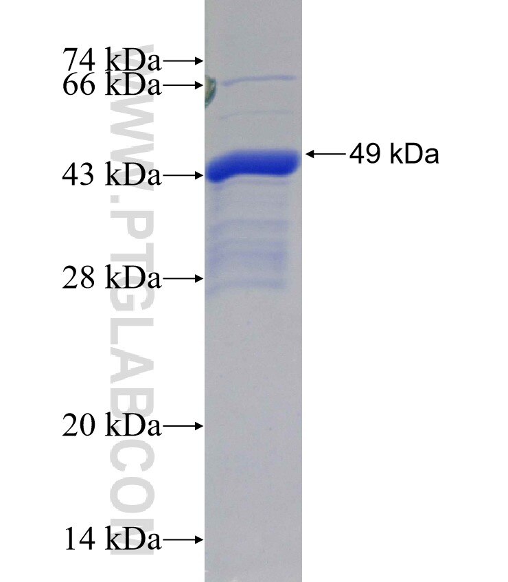 SEMA4B fusion protein Ag30422 SDS-PAGE