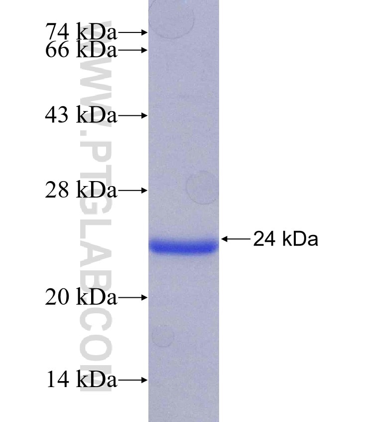 SEMA4B fusion protein Ag30441 SDS-PAGE SEMA4B fusion protein Ag30441 SDS-PAGE