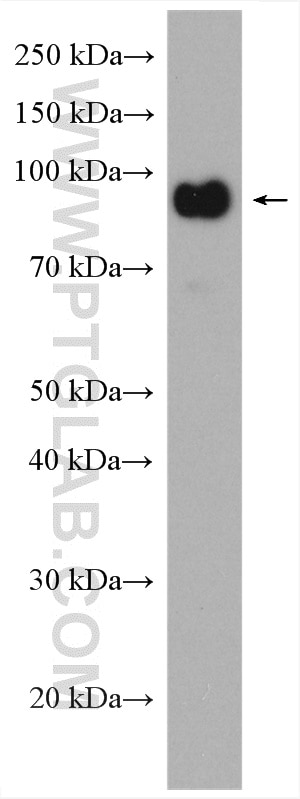 Western Blot (WB) analysis of mouse brain tissue using SEMA4C Polyclonal antibody (28402-1-AP)