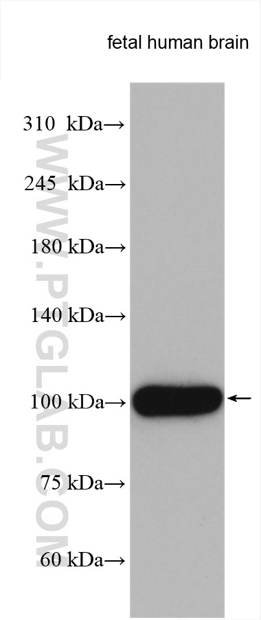 Western Blot (WB) analysis of various lysates using SEMA4C Polyclonal antibody (28402-1-AP)