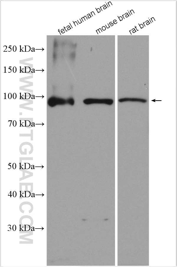 Western Blot (WB) analysis of various lysates using SEMA4C Polyclonal antibody (28402-1-AP)