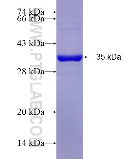 SEMA4C fusion protein Ag29142 SDS-PAGE SEMA4C fusion protein Ag29142 SDS-PAGE