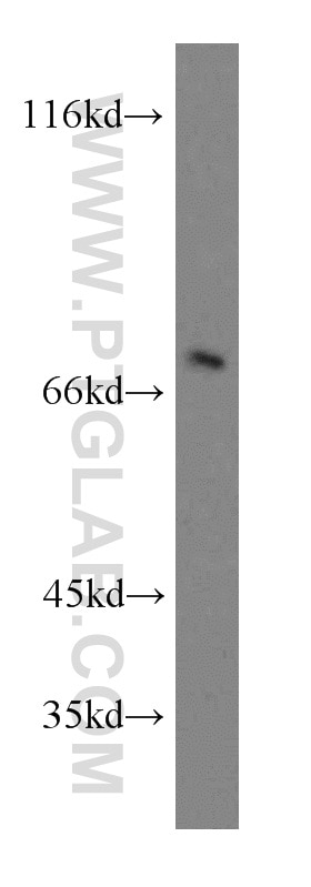 Western Blot (WB) analysis of HepG2 cells using SEMA4F Polyclonal antibody (12474-1-AP)