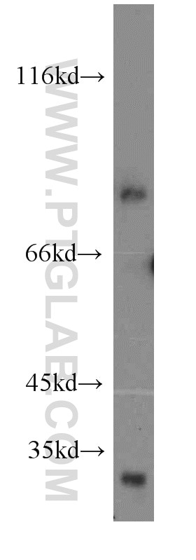 Western Blot (WB) analysis of mouse brain tissue using SEMA4F Polyclonal antibody (12474-1-AP)