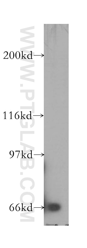 Western Blot (WB) analysis of human liver tissue using SEMA4F Polyclonal antibody (12474-1-AP)