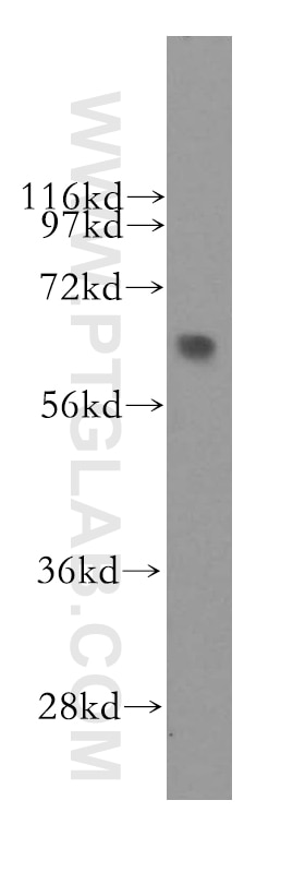 Western Blot (WB) analysis of mouse lung tissue using SEMA4F Polyclonal antibody (12474-1-AP)