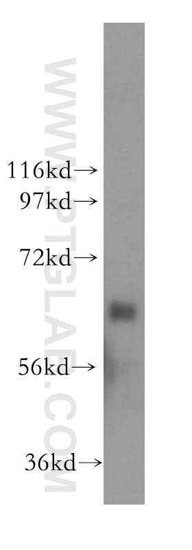 Western Blot (WB) analysis of Y79 cells using SEMA4F Polyclonal antibody (12474-1-AP)