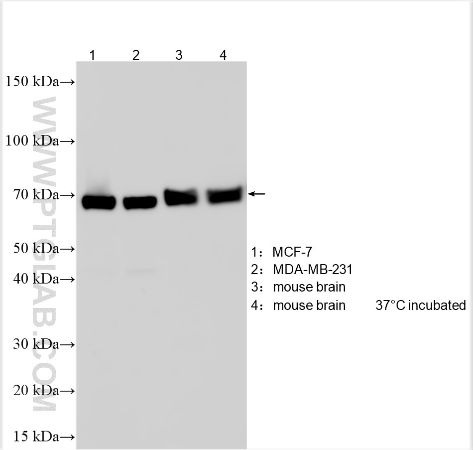 Western Blot (WB) analysis of various lysates using SEMA6B Polyclonal antibody (22571-1-AP)