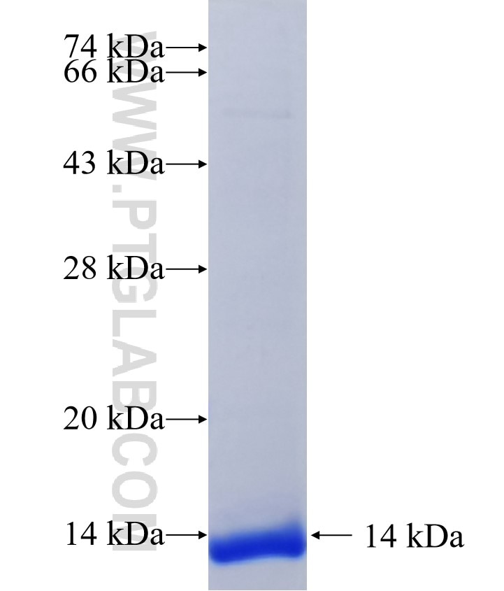SEMA6D fusion protein Ag37724 SDS-PAGE SEMA6D fusion protein Ag37724 SDS-PAGE