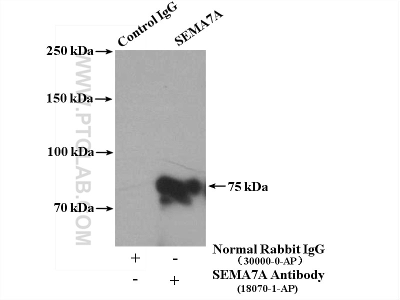 Immunoprecipitation (IP) experiment of human placenta tissue using SEMA7A Polyclonal antibody (18070-1-AP)