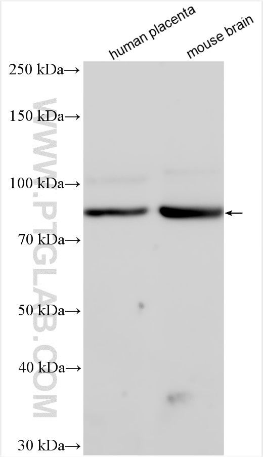 Western Blot (WB) analysis of various lysates using SEMA7A Polyclonal antibody (18070-1-AP)