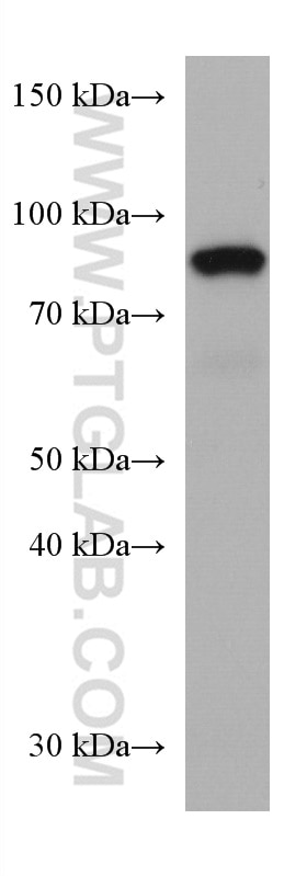 Western Blot (WB) analysis of human red blood cells using SEMA7A Monoclonal antibody (67397-1-Ig)