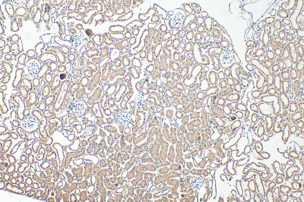 Immunohistochemistry (IHC) staining of mouse kidney tissue using Semenogelin-1 Polyclonal antibody (15916-1-AP)