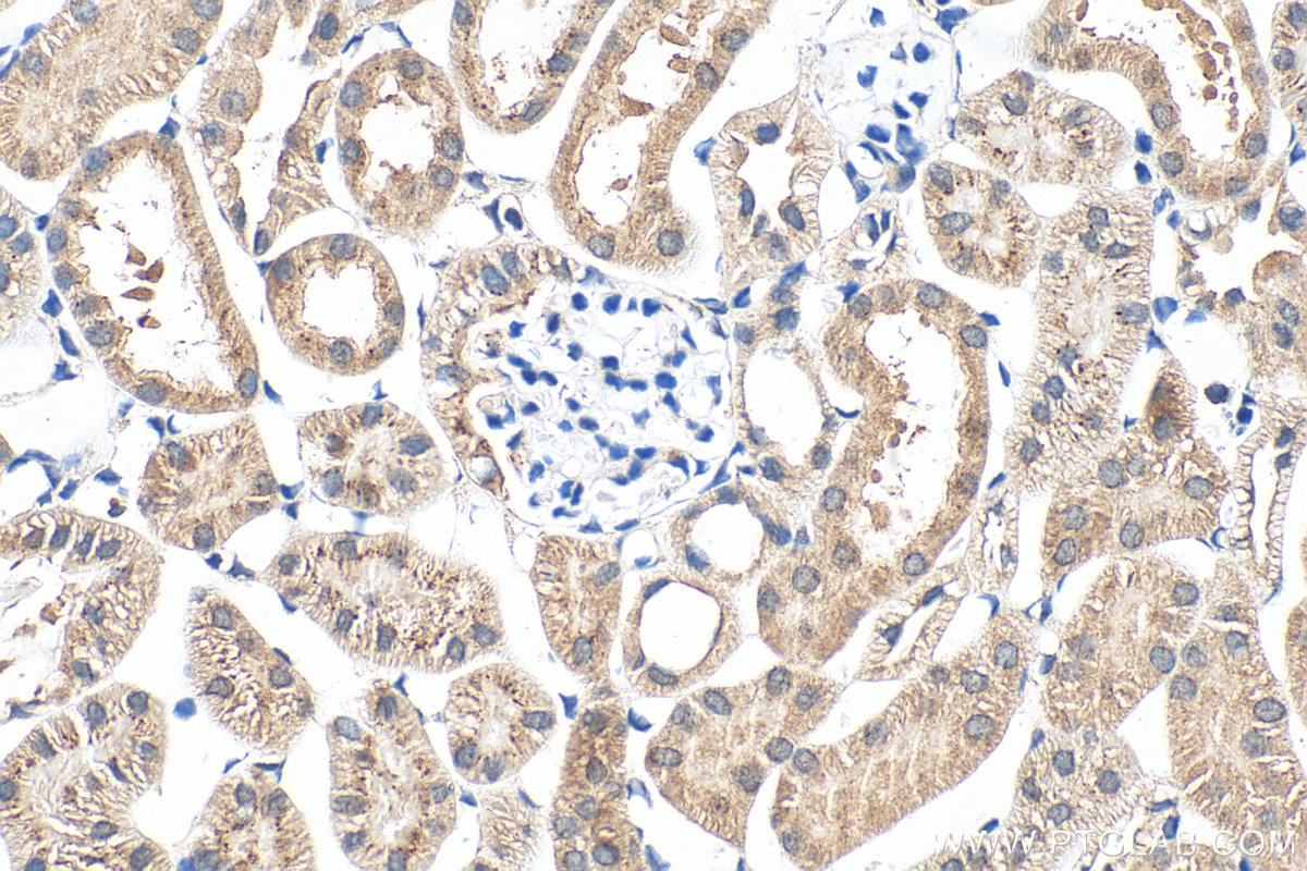 Immunohistochemistry (IHC) staining of mouse kidney tissue using Semenogelin-1 Polyclonal antibody (15916-1-AP)