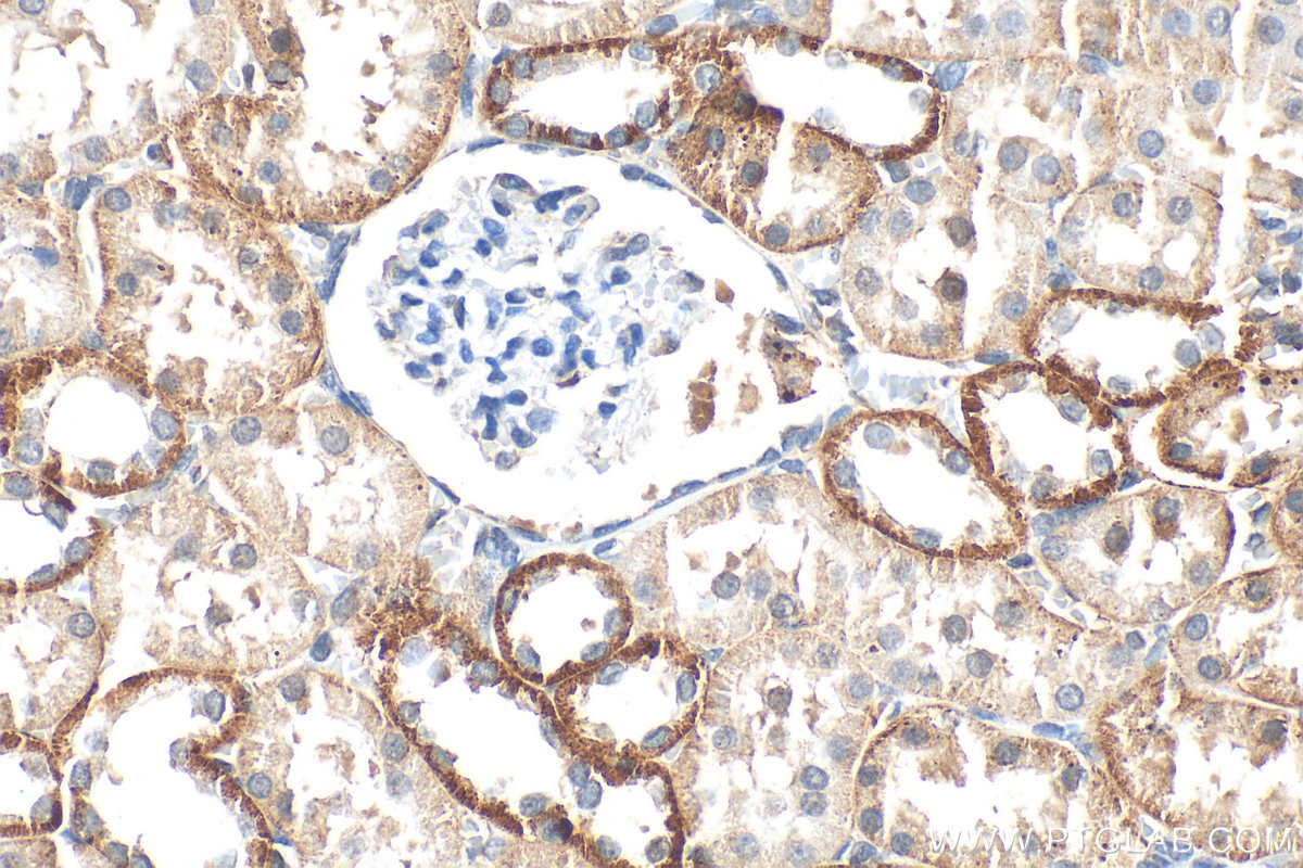 Immunohistochemistry (IHC) staining of rat kidney tissue using Semenogelin-1 Polyclonal antibody (15916-1-AP)