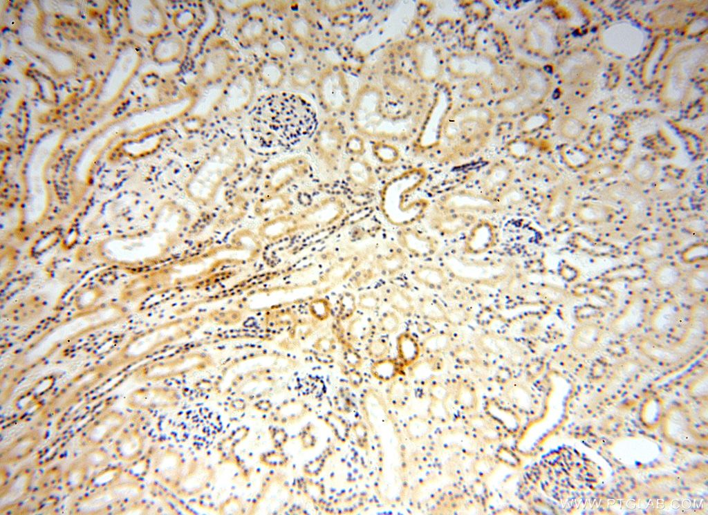 Immunohistochemistry (IHC) staining of human kidney tissue using Semenogelin-1 Polyclonal antibody (15916-1-AP)