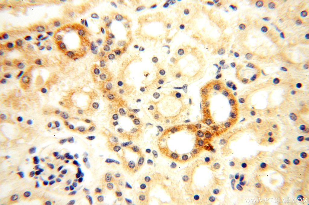 Immunohistochemistry (IHC) staining of human kidney tissue using Semenogelin-1 Polyclonal antibody (15916-1-AP)