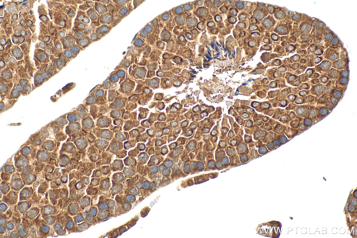 Immunohistochemistry (IHC) staining of mouse testis tissue using SEMG2 Polyclonal antibody (31203-1-AP)