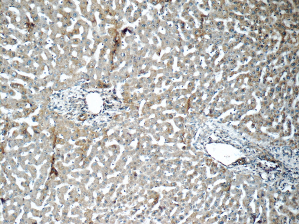 Immunohistochemistry (IHC) staining of human liver tissue using SENP1 Polyclonal antibody (25349-1-AP)