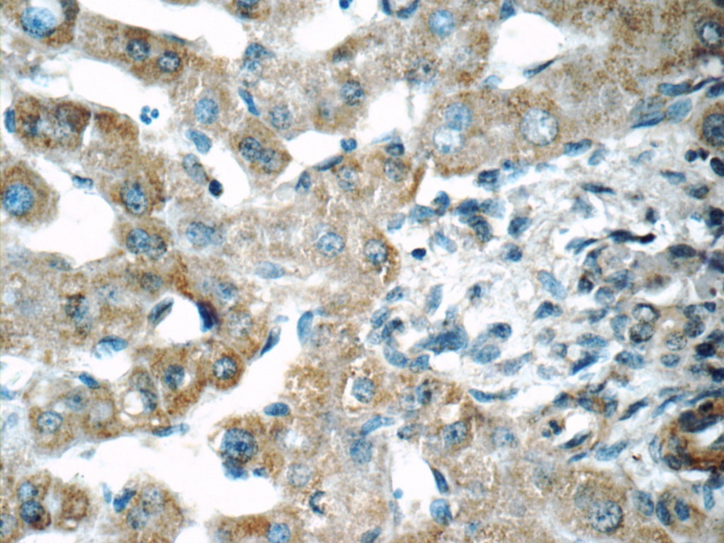 Immunohistochemistry (IHC) staining of human liver tissue using SENP1 Polyclonal antibody (25349-1-AP)