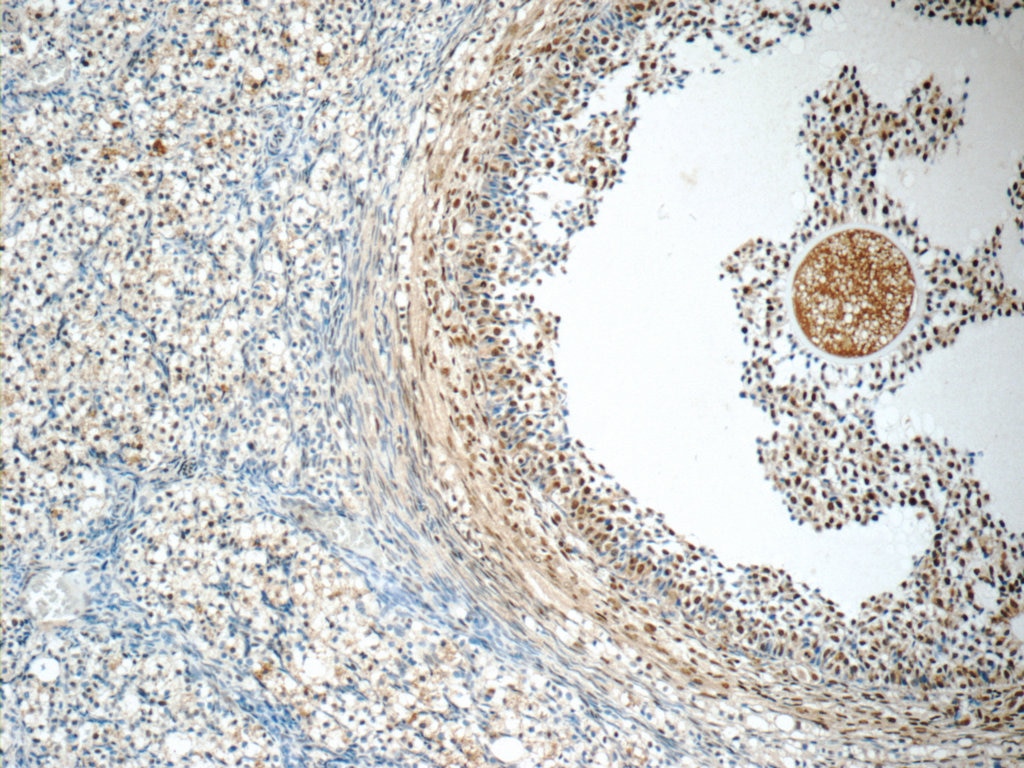 Immunohistochemistry (IHC) staining of human ovary tissue using SENP1 Polyclonal antibody (25349-1-AP)