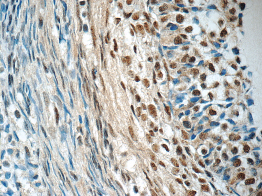Immunohistochemistry (IHC) staining of human ovary tissue using SENP1 Polyclonal antibody (25349-1-AP)