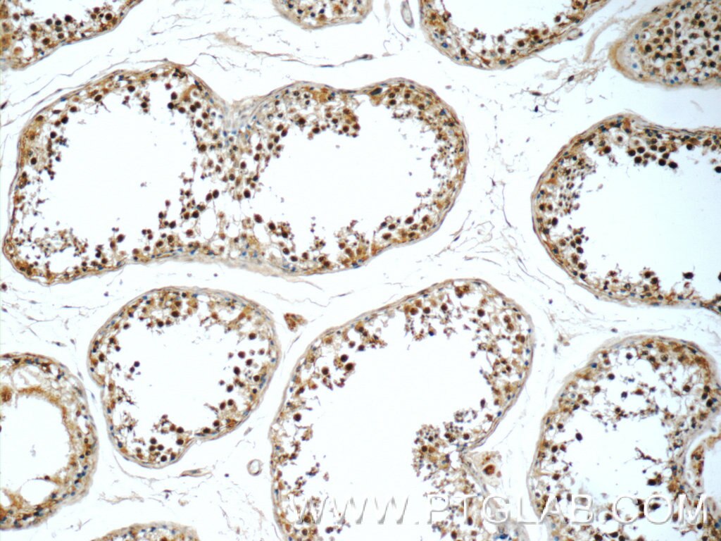 IHC staining of human testis using 25349-1-AP