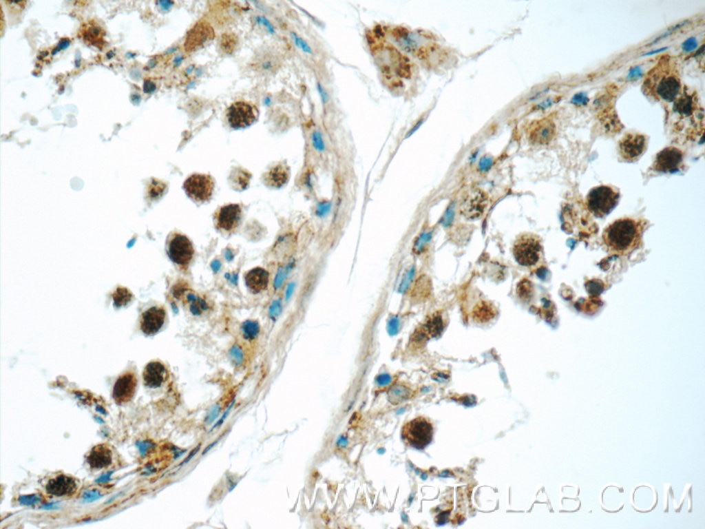 Immunohistochemistry (IHC) staining of human testis tissue using SENP1 Polyclonal antibody (25349-1-AP)