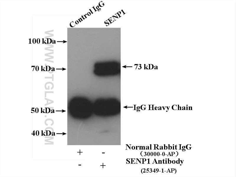 Immunoprecipitation (IP) experiment of Jurkat cells using SENP1 Polyclonal antibody (25349-1-AP)