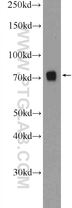 SENP1 Polyclonal antibody