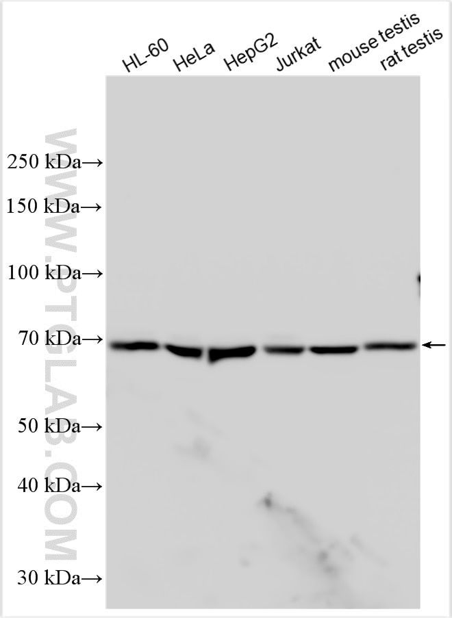 Western Blot (WB) analysis of various lysates using SENP1 Polyclonal antibody (25349-1-AP)