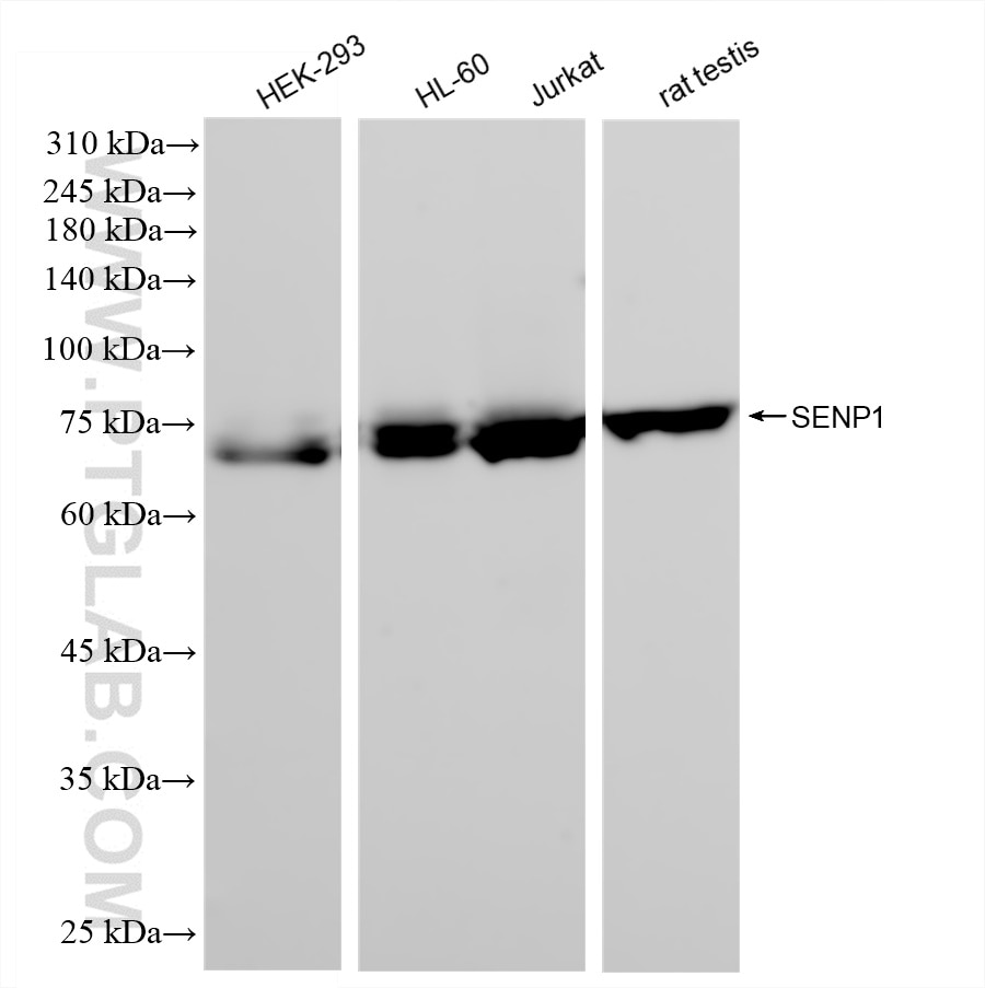 Western Blot (WB) analysis of various lysates using SENP1 Recombinant antibody (83594-4-RR)