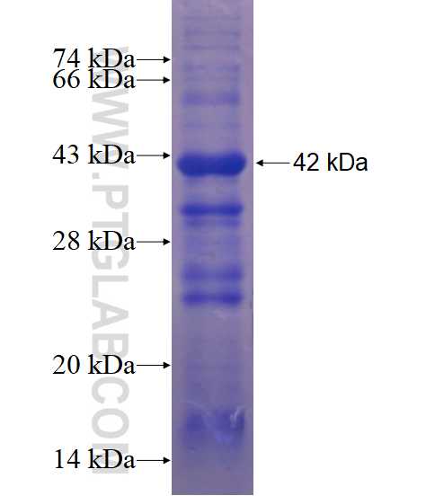SENP1 fusion protein Ag18708 SDS-PAGE