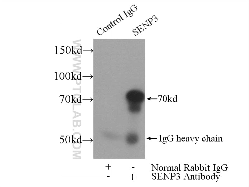 Immunoprecipitation (IP) experiment of Y79 cells using SENP3 Polyclonal antibody (17659-1-AP)