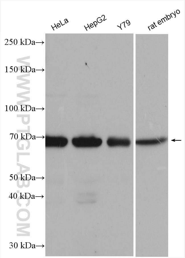 Western Blot (WB) analysis of various lysates using SENP3 Polyclonal antibody (17659-1-AP)
