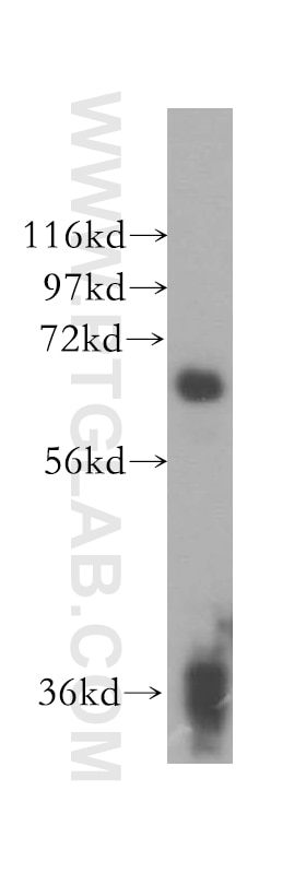 Western Blot (WB) analysis of HeLa cells using SENP3 Polyclonal antibody (17659-1-AP)