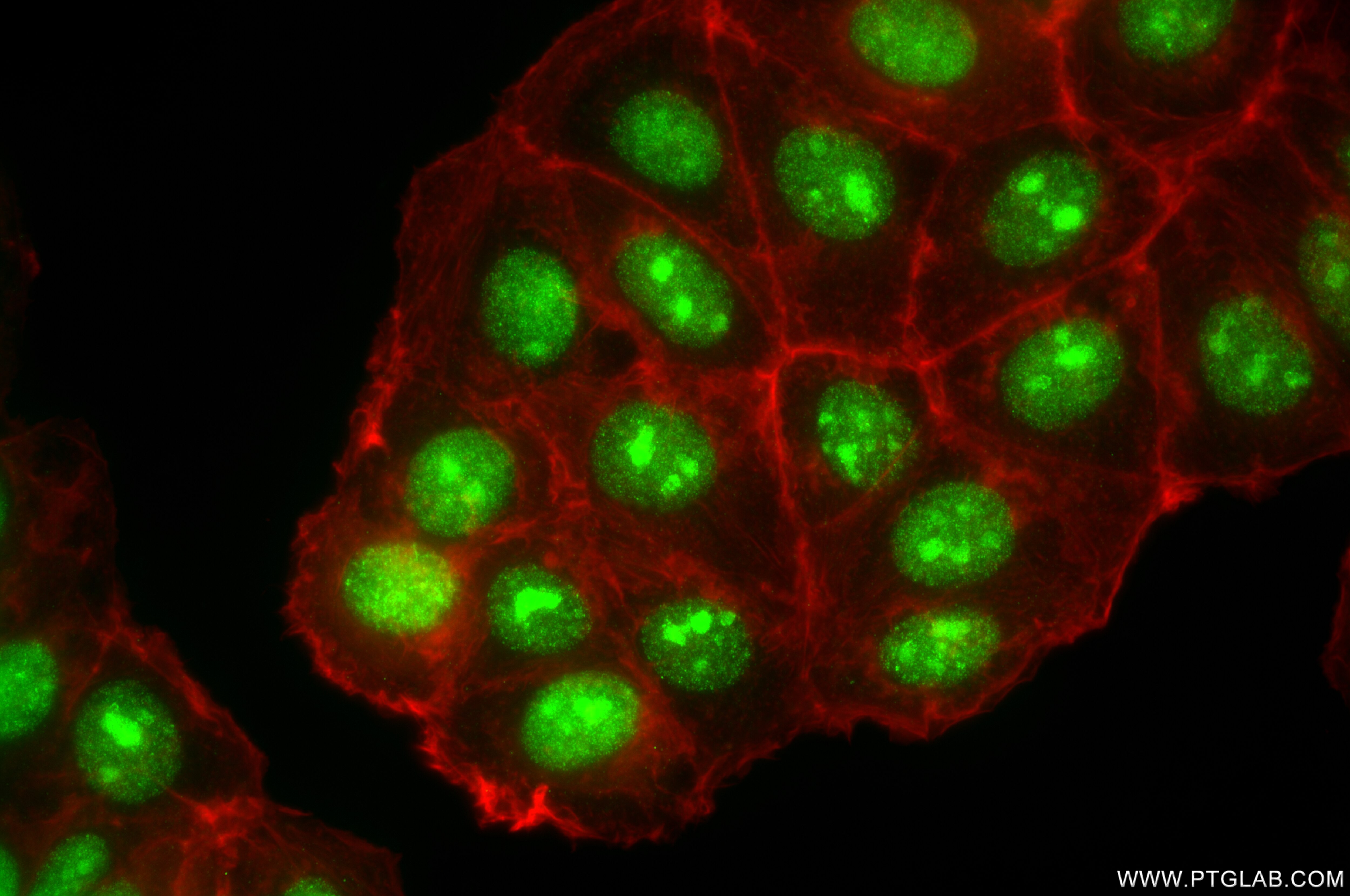 Immunofluorescence (IF) / fluorescent staining of MCF-7 cells using SENP3 Recombinant antibody (85837-3-RR)
