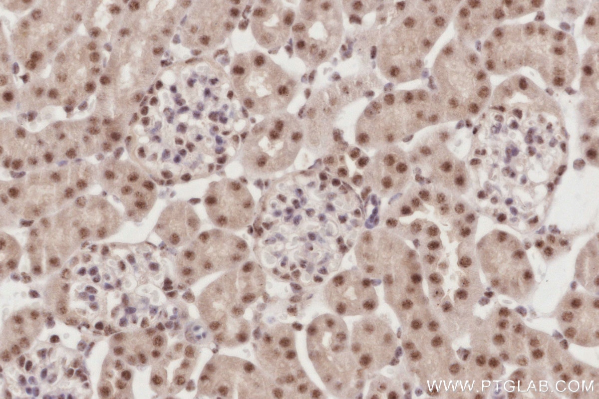 IHC staining of mouse kidney using 85837-3-RR Immunohistochemistry (IHC) staining of mouse kidney tissue using SENP3 Recombinant monoclonal antibody (85837-3-RR)