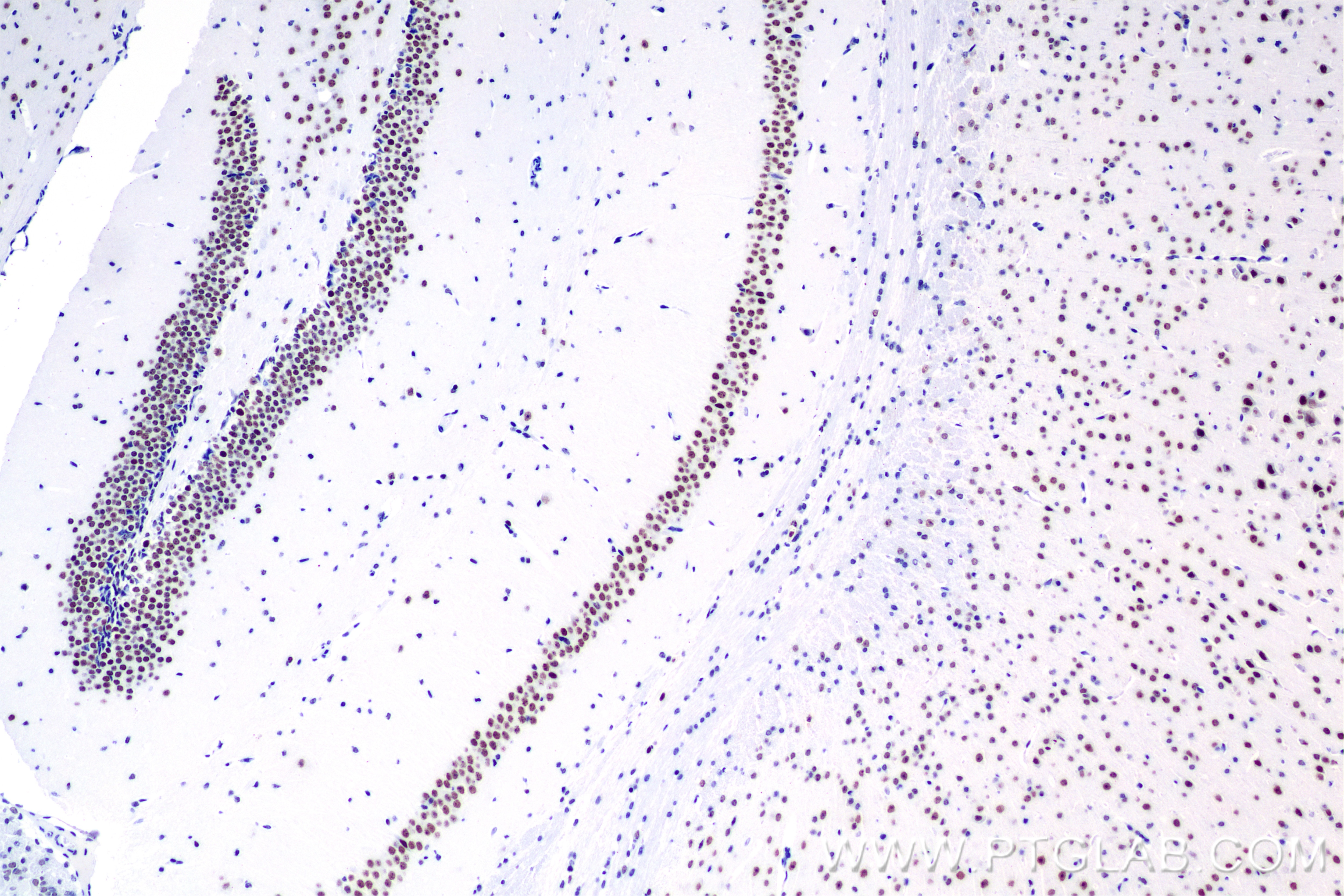 Immunohistochemistry (IHC) staining of mouse brain tissue using SENP3 Recombinant antibody (85837-3-RR)