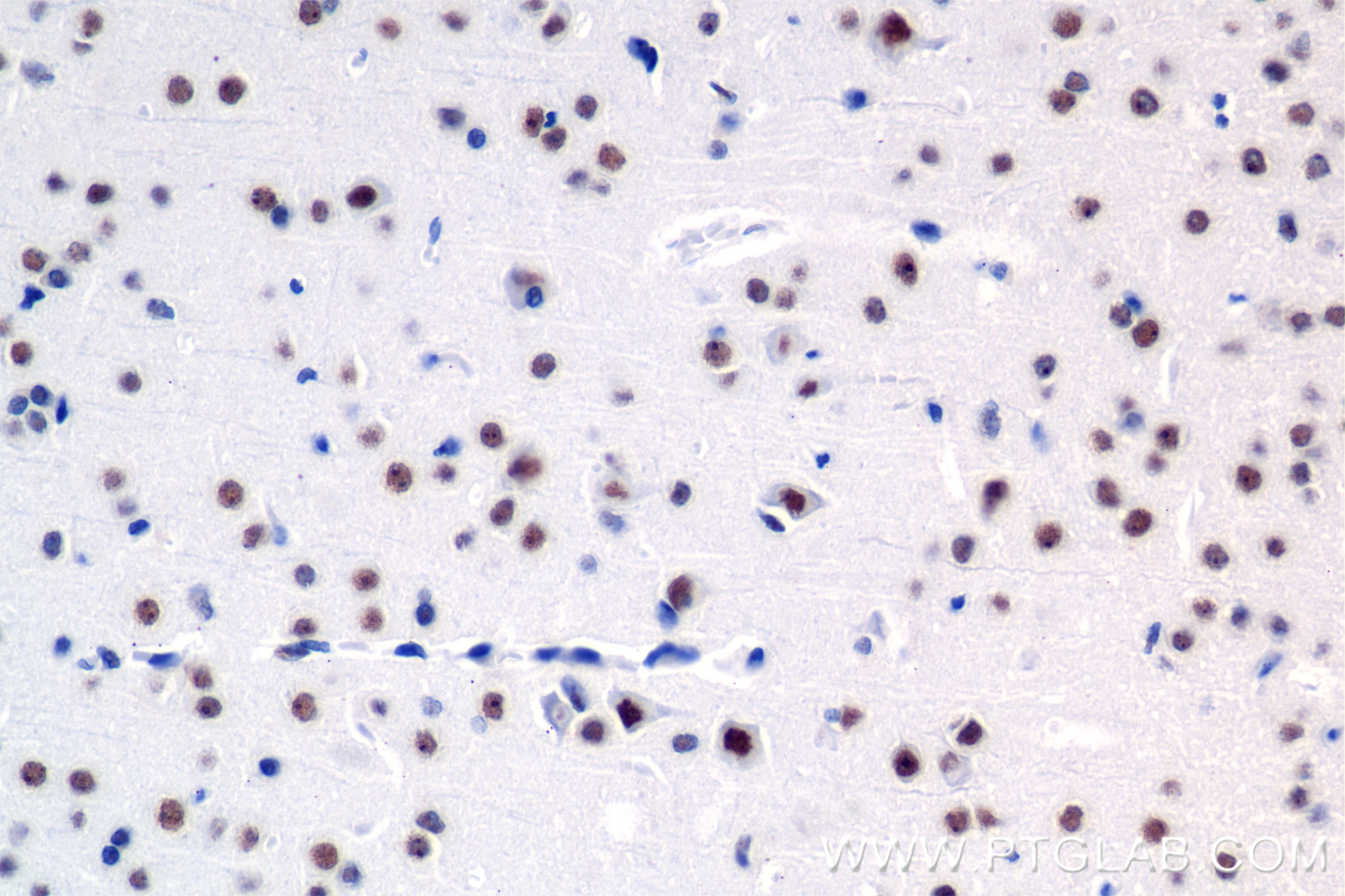 Immunohistochemistry (IHC) staining of mouse brain tissue using SENP3 Recombinant antibody (85837-3-RR)