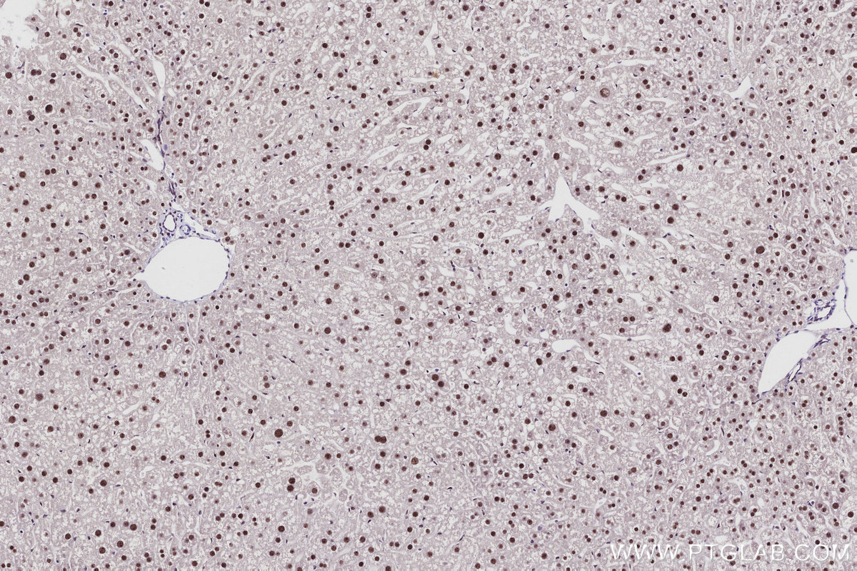 IHC staining of mouse liver using 85837-3-RR Immunohistochemistry (IHC) staining of mouse liver tissue using SENP3 Recombinant monoclonal antibody (85837-3-RR)
