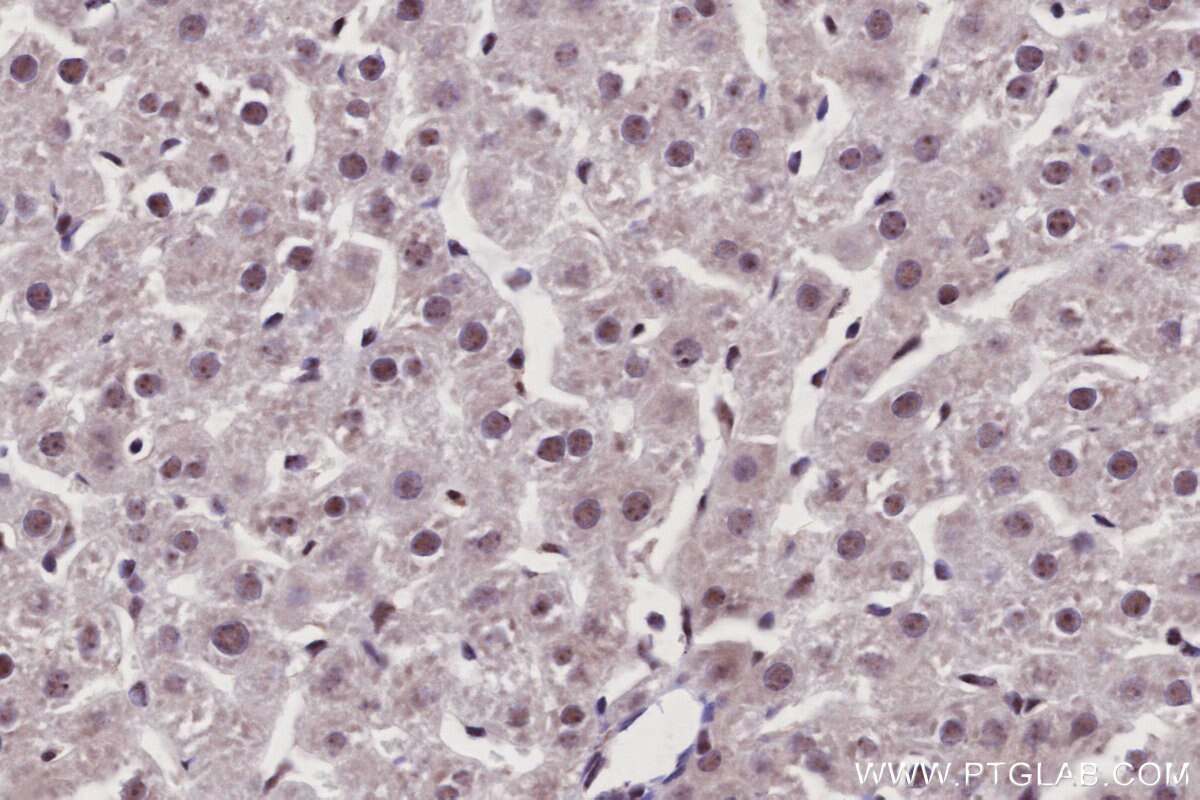 IHC staining of rat liver using 85837-3-RR Immunohistochemistry (IHC) staining of rat liver tissue using SENP3 Recombinant monoclonal antibody (85837-3-RR)