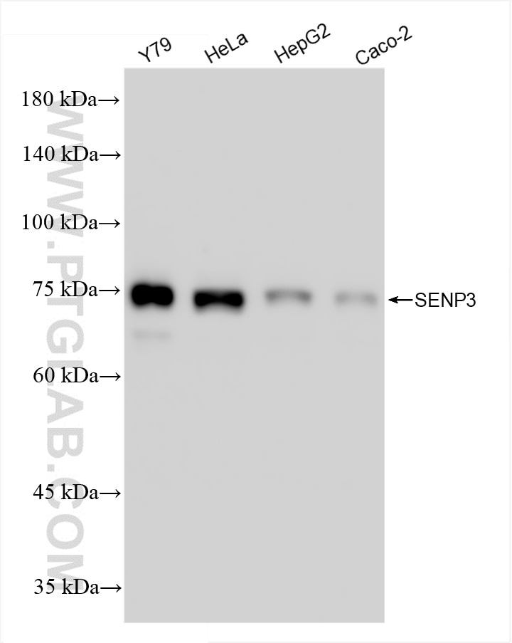 Western Blot (WB) analysis of various lysates using SENP3 Recombinant antibody (85837-3-RR)